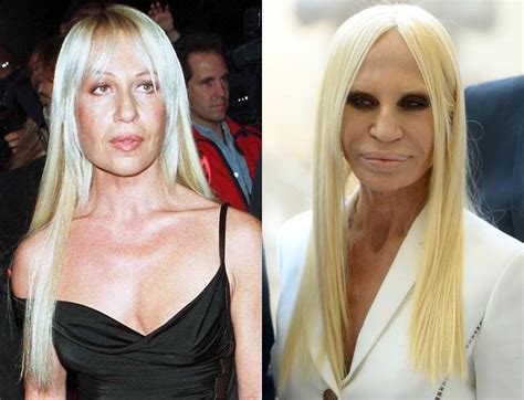 foto de donatella versace|donatella versace before and after.